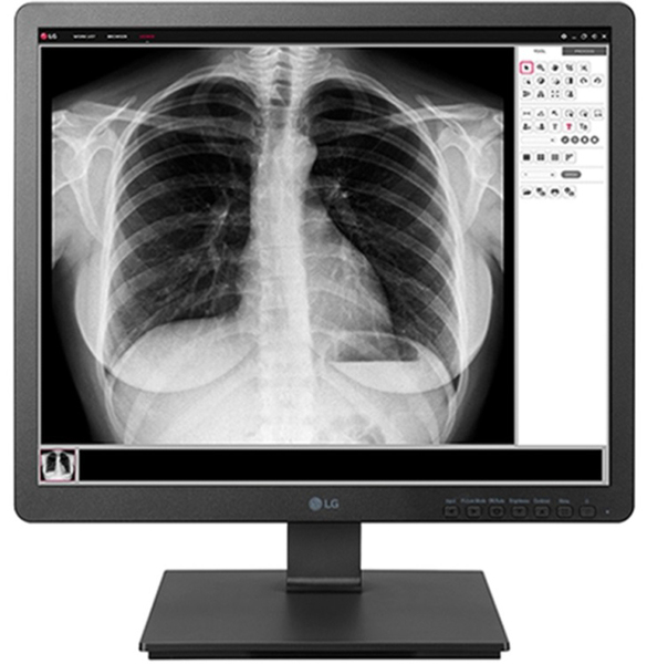 LG 19&quot; Clinical Review 19HK312C, 1280x720px, AH-IPS - sk&auml;rm