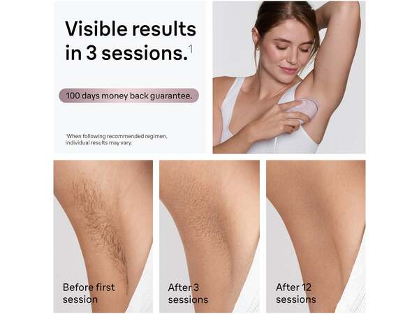 Braun Silk&middot;expert Mini IPL PL1100 - IPL-h&aring;rborttagningsenhet, ljusrosa