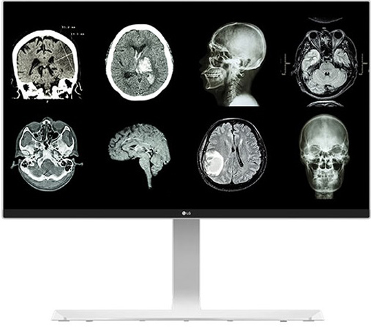 LG 27" Clinical Monitor 27HJ712C, 4K, IPS - monitor