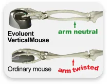 Evoluent VerticalMouse 4, liten h&ouml;ger - vertikal mus