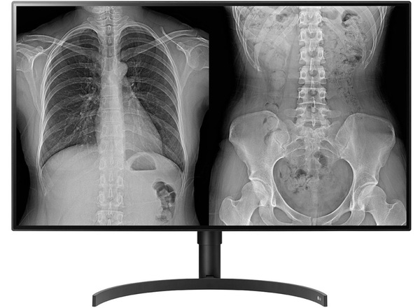 LG 31.5&quot; Diagnostic Monitor 32HL512D, 4K, IPS - monitor