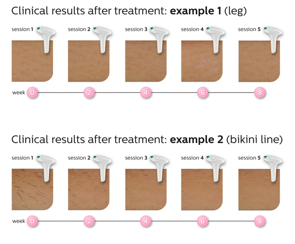 Philips SC1995/0 White