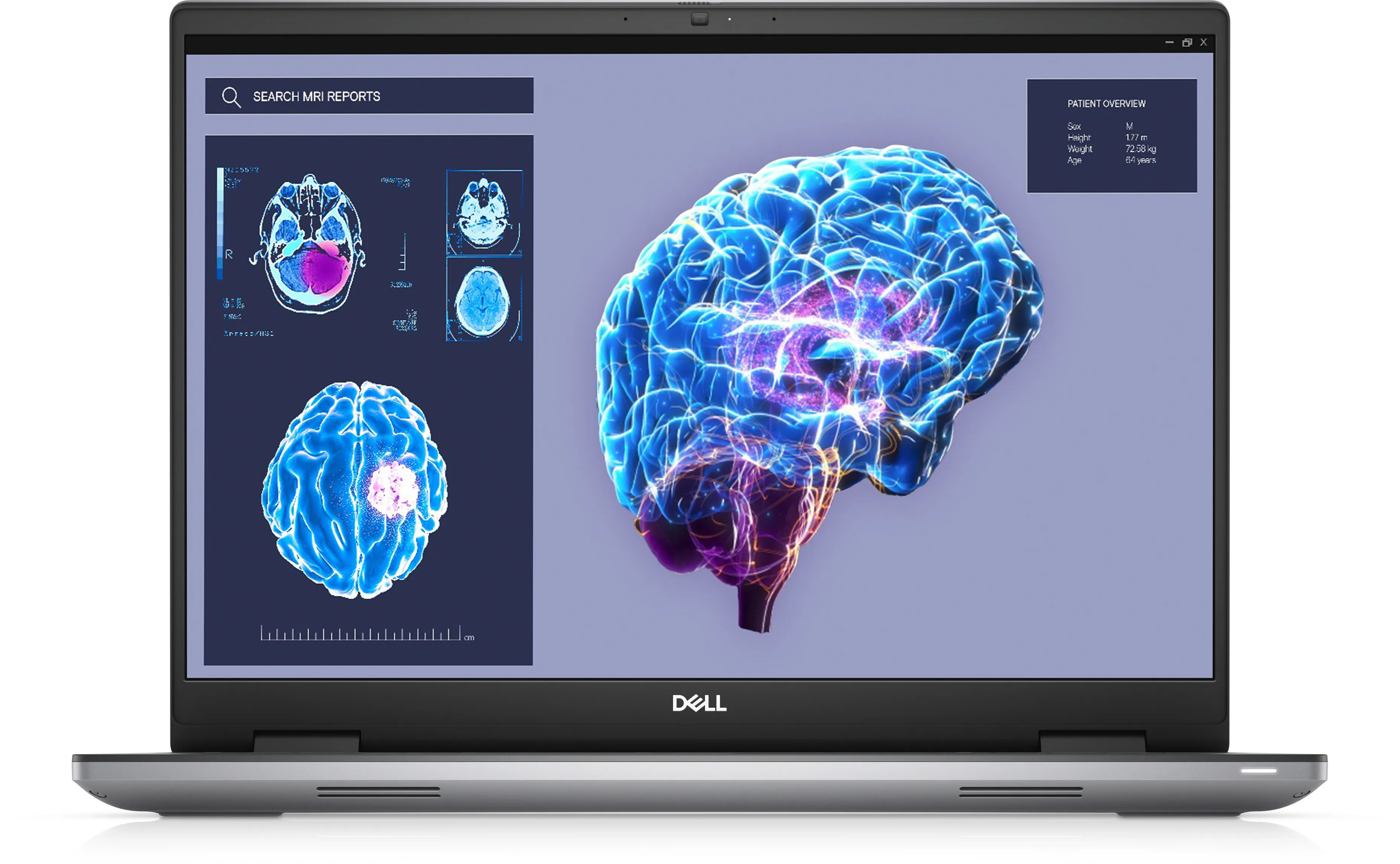 Dell Precision 7680 16" i9-13950HX, 16 GB, 1 TB SSD, RTX 3500, Win 11 Pro - bärbar dator, Grå