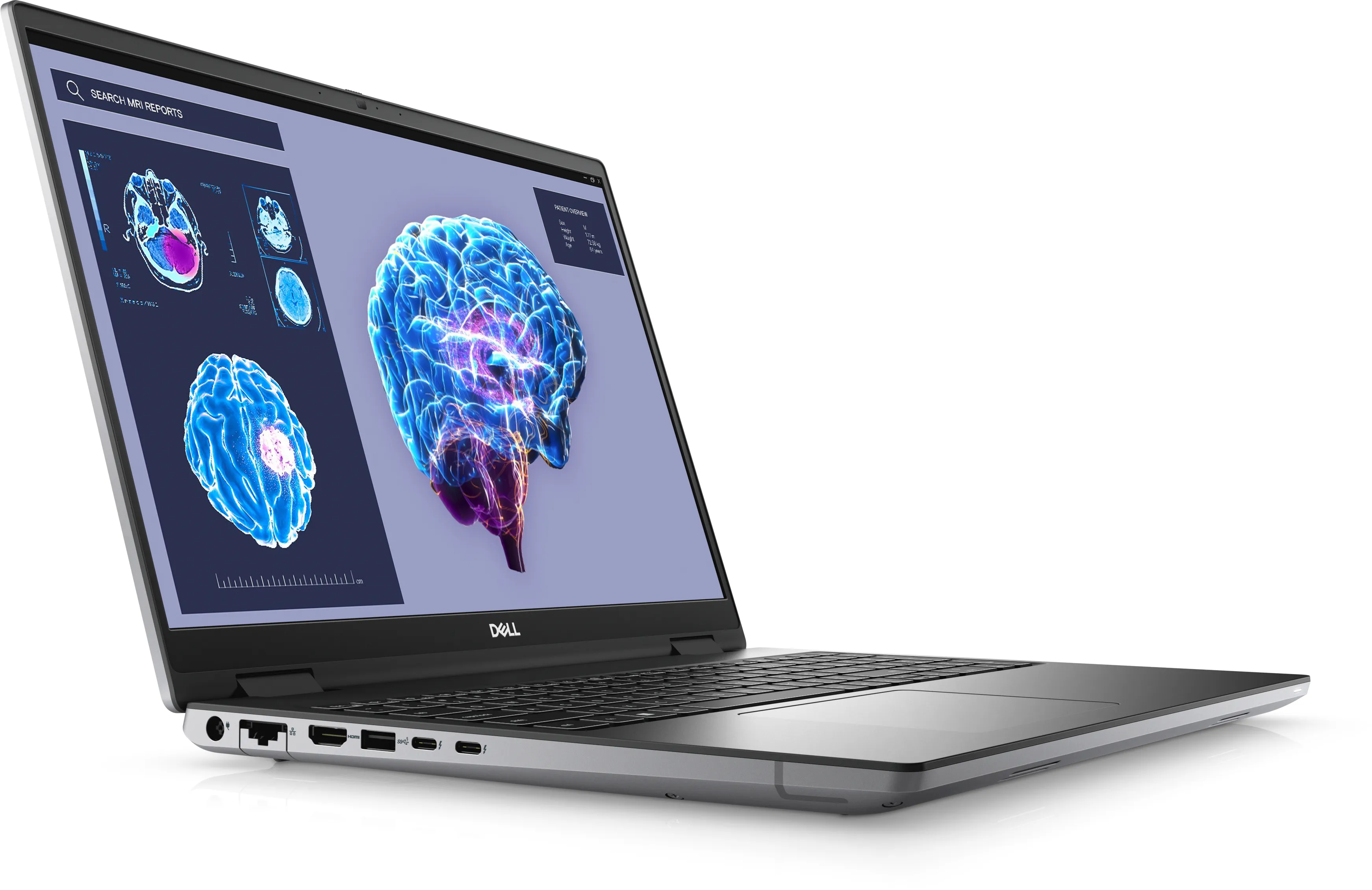 Dell Precision 7680 16" i9-13950HX, 16 GB, 1 TB SSD, RTX 3500, Win 11 Pro - bärbar dator, Grå
