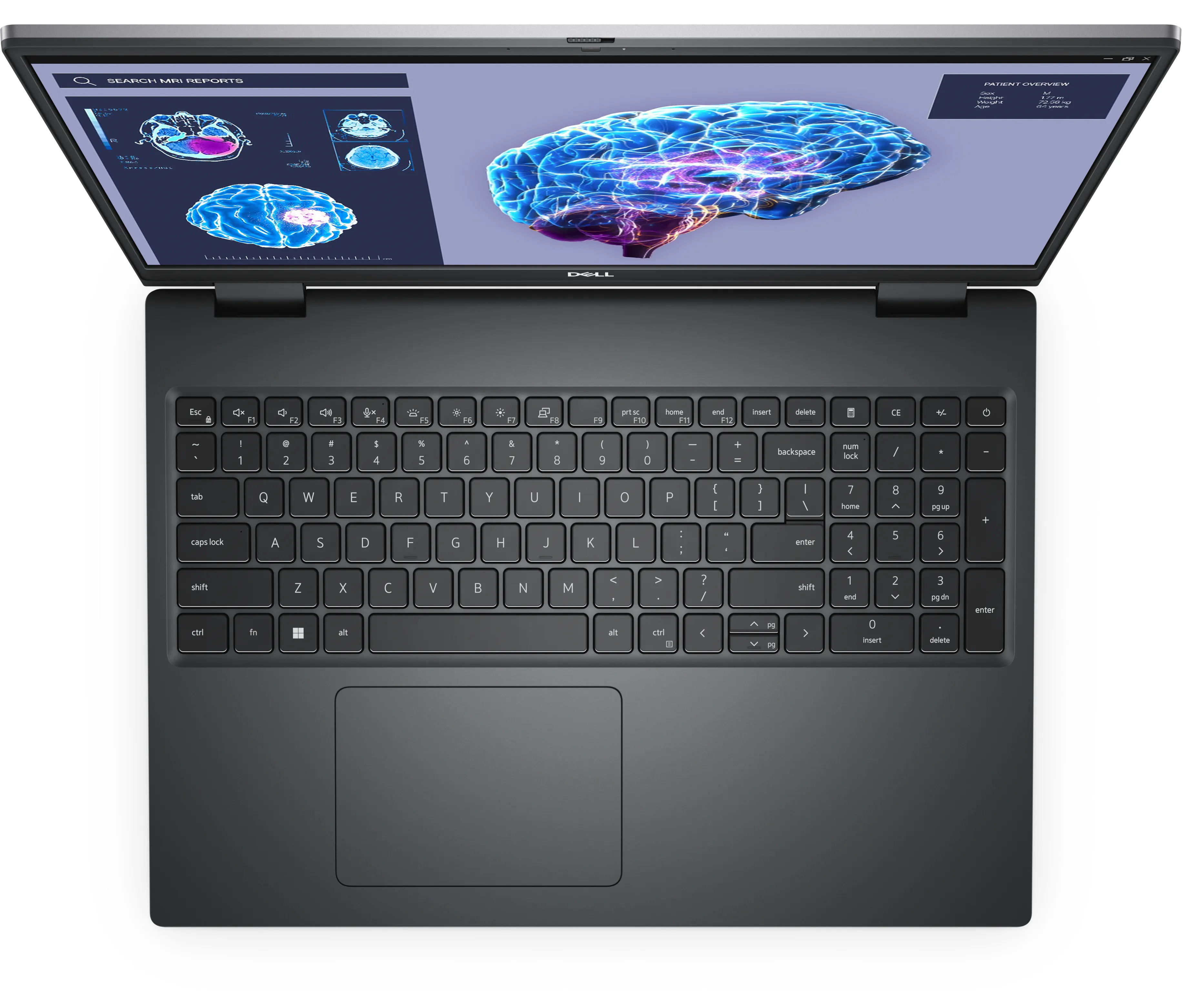 Dell Precision 7680 16&quot; i9-13950HX, 16 GB, 1 TB SSD, RTX 3500, Win 11 Pro - b&auml;rbar dator, Gr&aring;