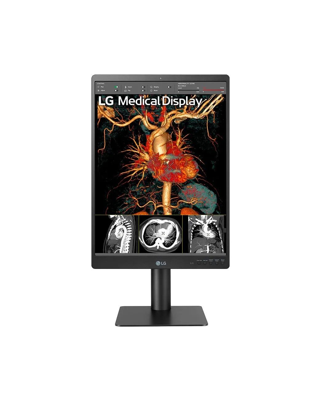 LG DIAGNOSTIC MONITOR, 21.3&quot;, 3MP, 1100CD/M2, NTSC 72%, HAS/PIVOT, FRONT CALIBRATION SENSOR