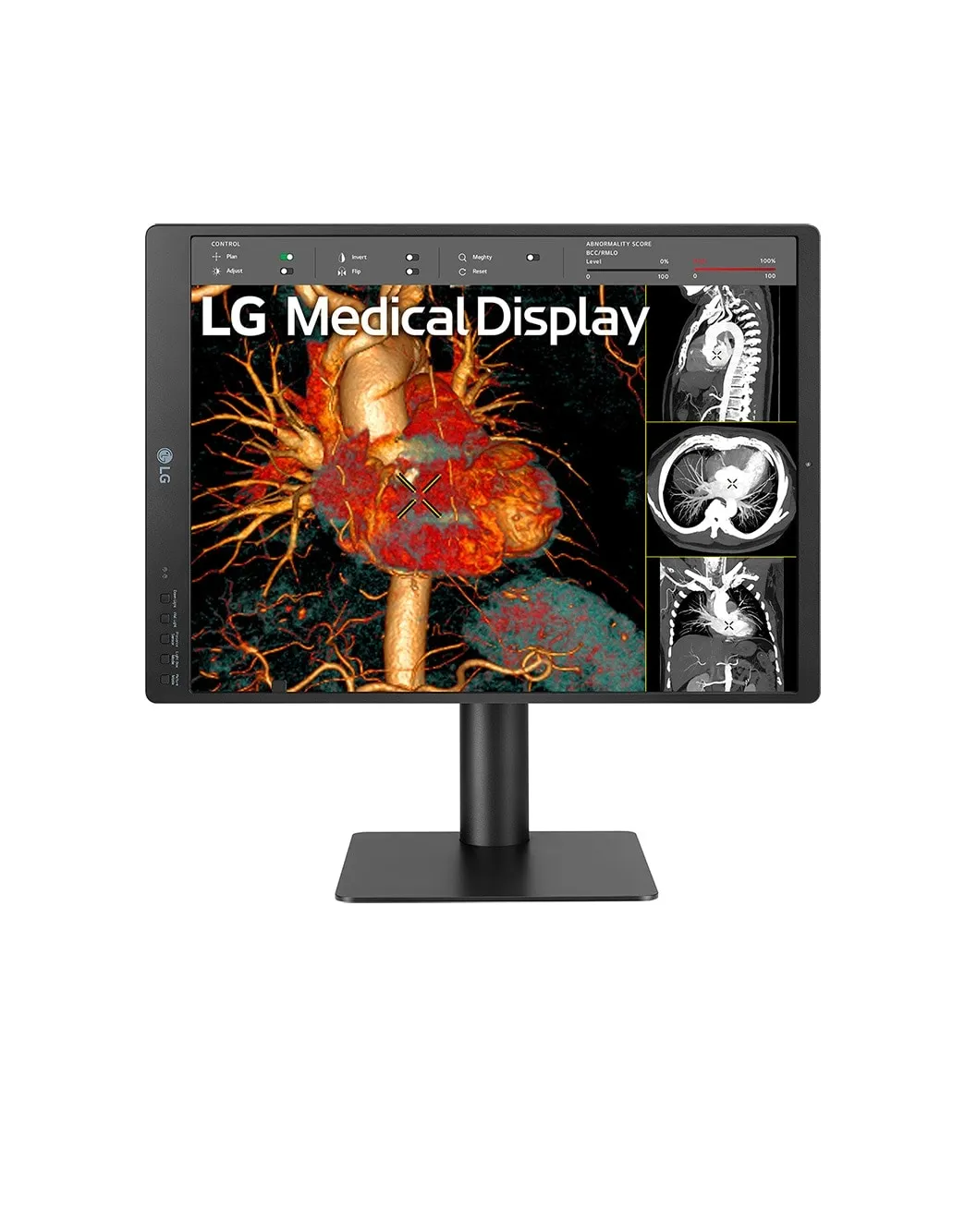 LG DIAGNOSTIC MONITOR, 21.3&quot;, 3MP, 1100CD/M2, NTSC 72%, HAS/PIVOT, FRONT CALIBRATION SENSOR