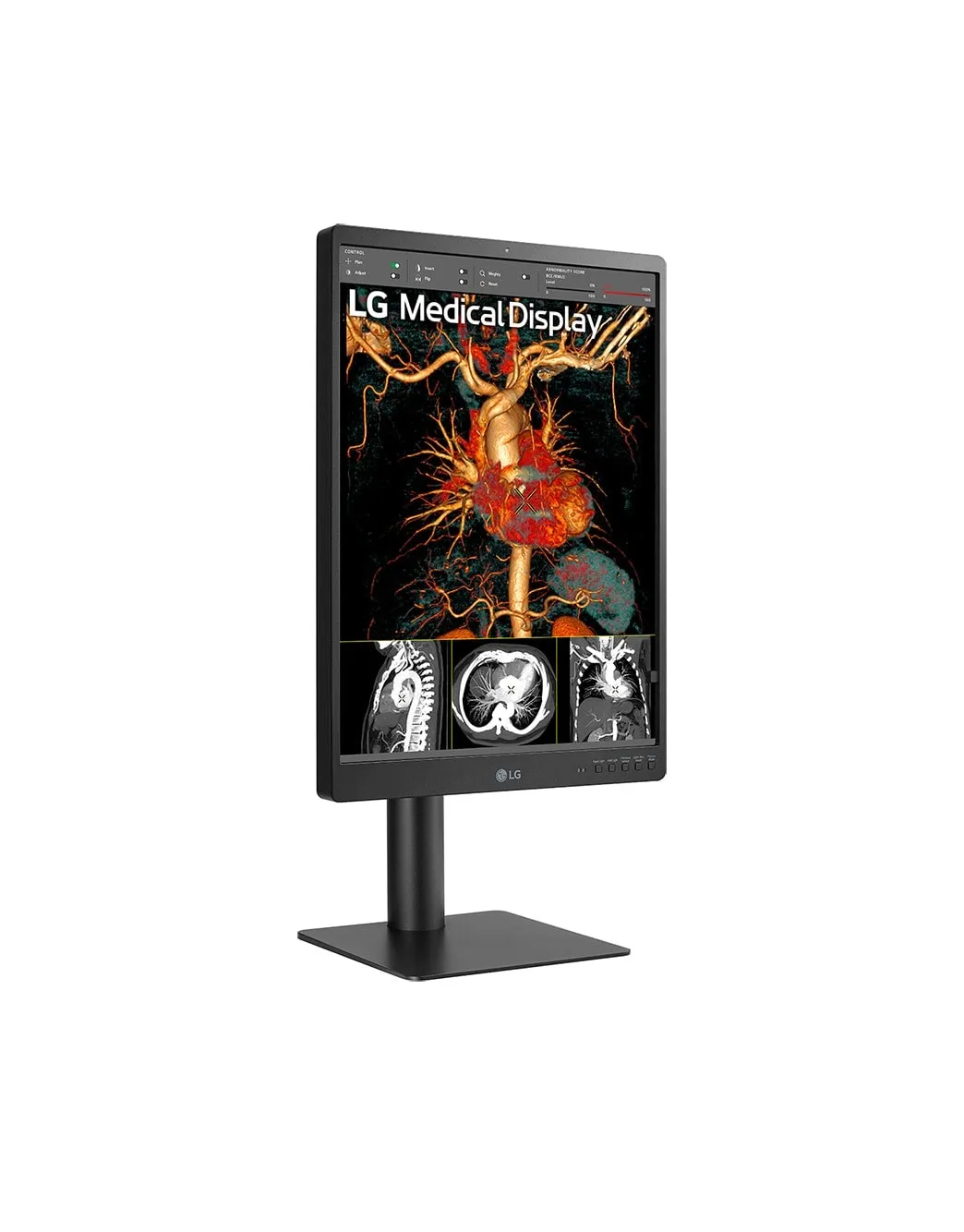 LG DIAGNOSTIC MONITOR, 21.3&quot;, 3MP, 1100CD/M2, NTSC 72%, HAS/PIVOT, FRONT CALIBRATION SENSOR