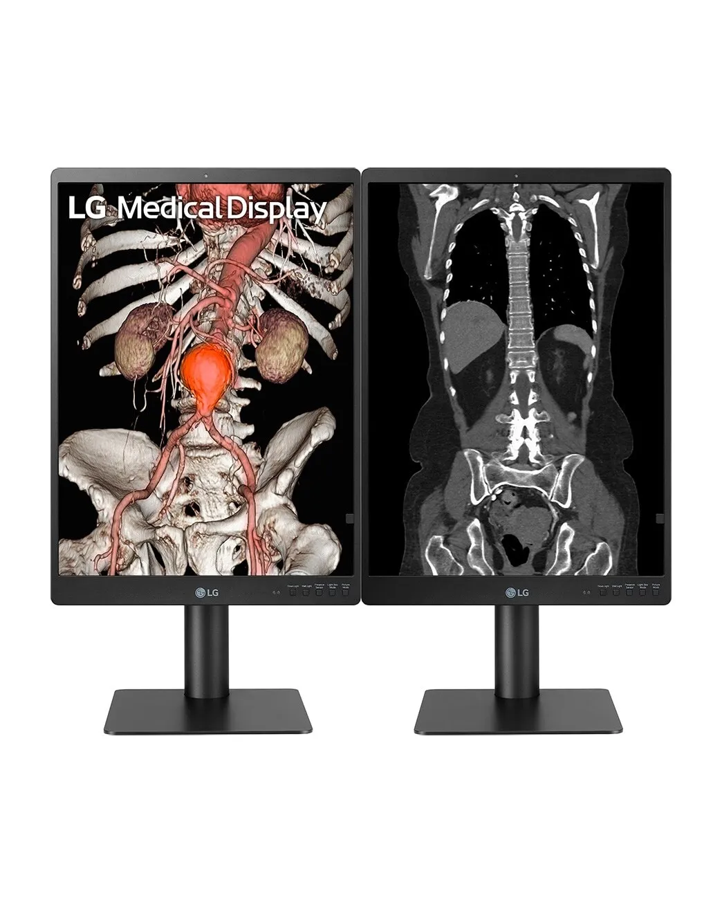 LG DIAGNOSTIC MONITOR, 21.3&quot;, 3MP, 1100CD/M2, NTSC 72%, HAS/PIVOT, FRONT CALIBRATION SENSOR