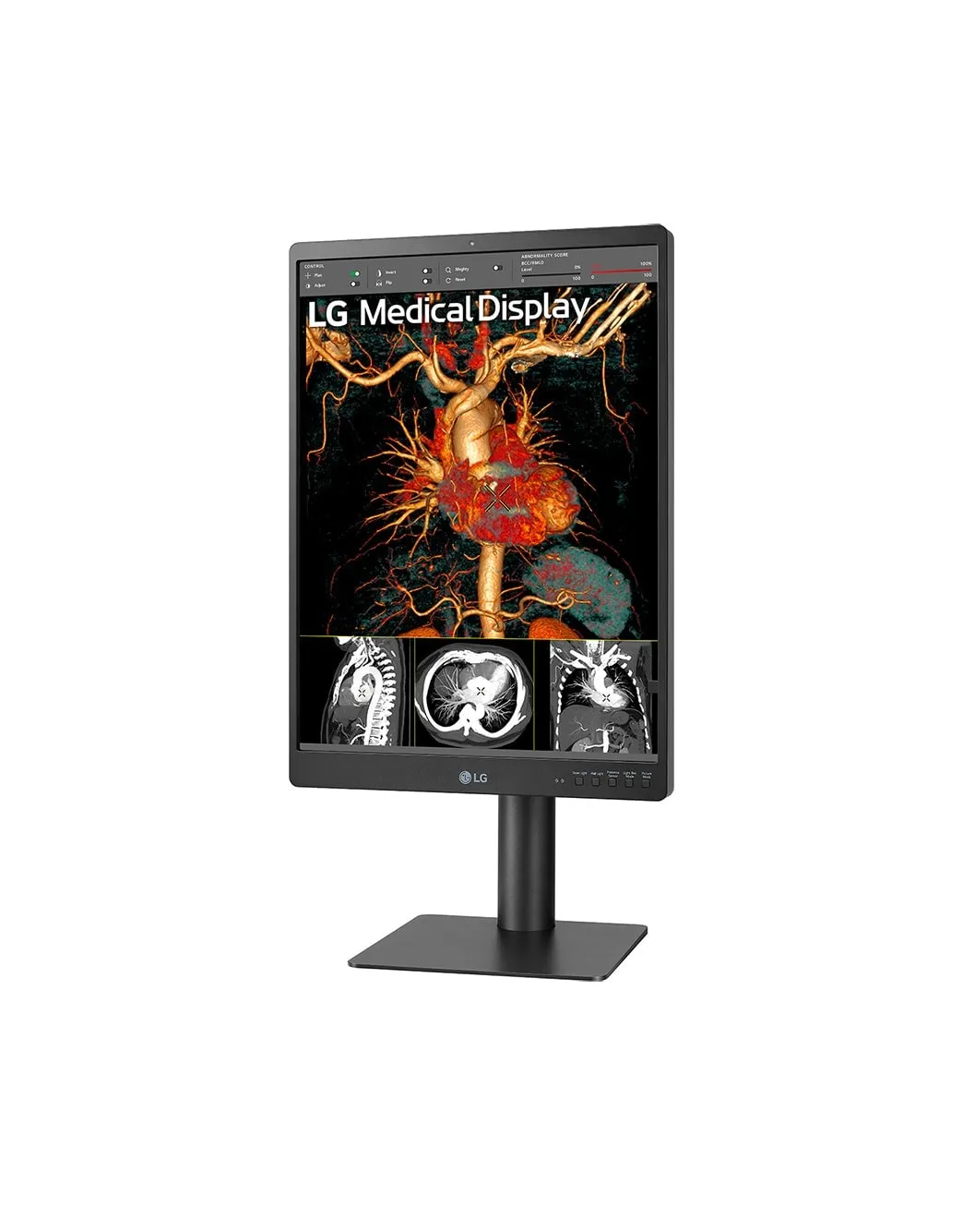 LG DIAGNOSTIC MONITOR, 21.3&quot;, 3MP, 1100CD/M2, NTSC 72%, HAS/PIVOT, FRONT CALIBRATION SENSOR