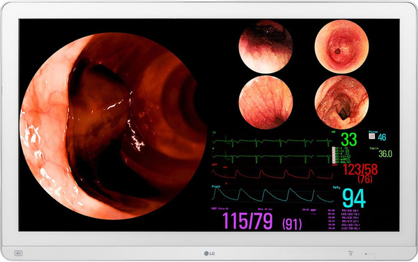 LG 31.5&quot; Surgical Monitor 32HL710S, 4K, IPS - sk&auml;rm