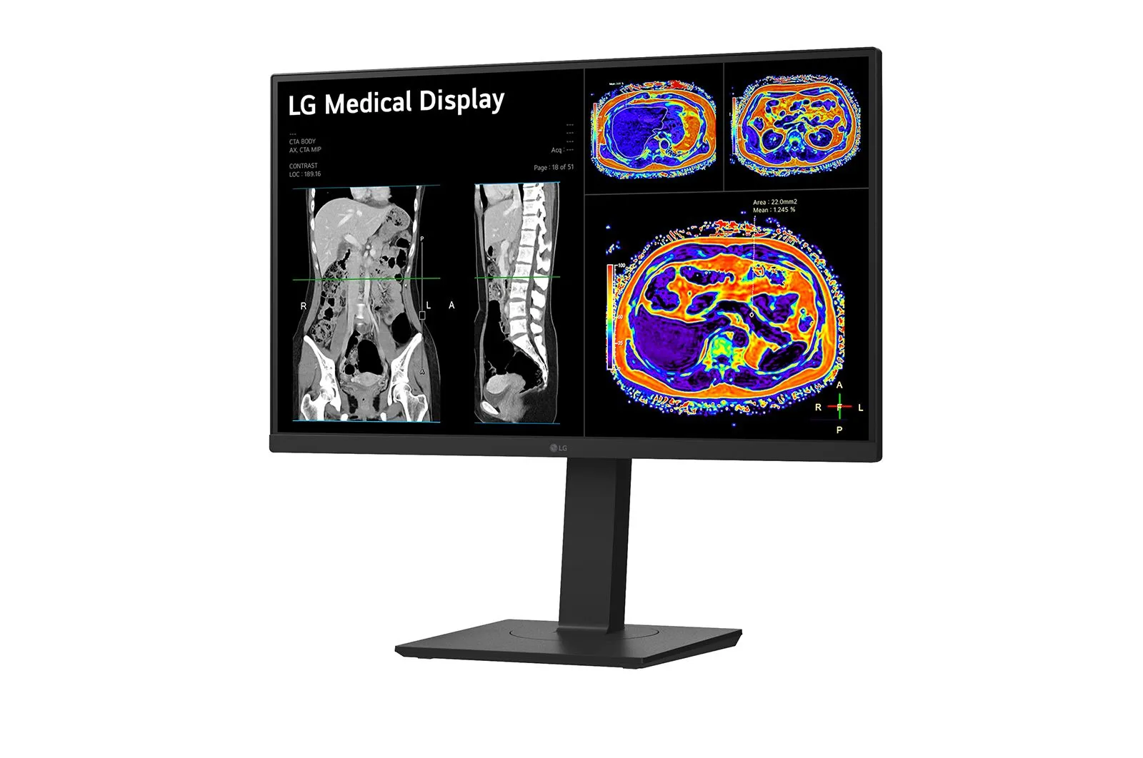 LG 27HS713C-B 27" 4K UHD, IPS Monitor with USB-C hub